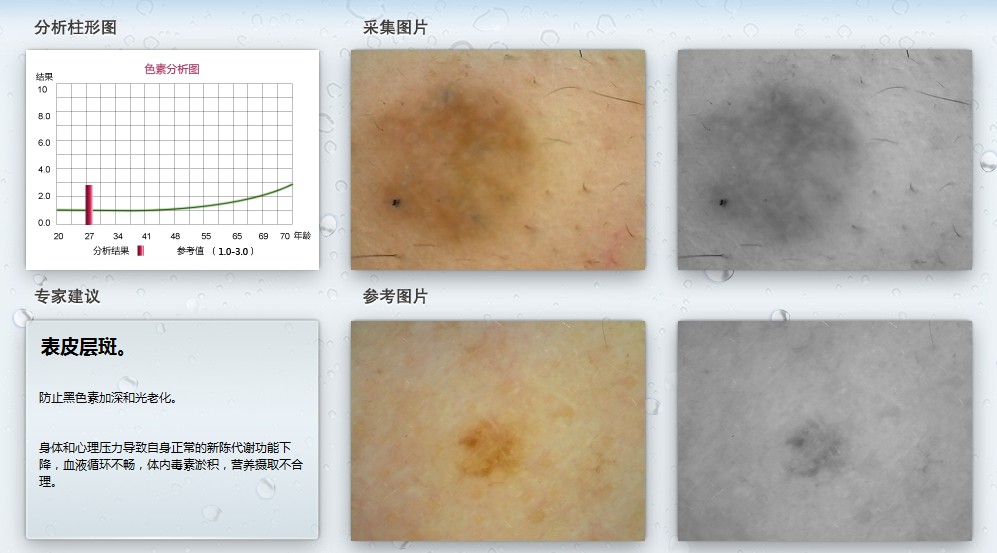 皮膚測試儀 科學(xué)護(hù)膚的智能助手